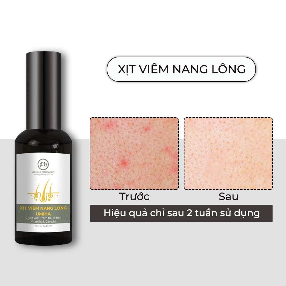 Xịt viêm nang lông viêm lỗ chân lông UMIHA  50/15ML Giảm viêm nang lông, mụn lưng, ngực mông, mờ thâm sáng da