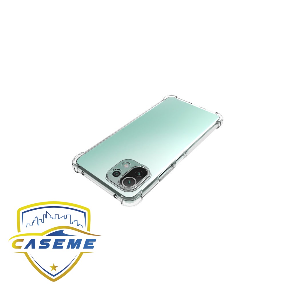 Ốp lưng dành cho Xiaomi Mi 11 Pro dẻo trong chống sốc