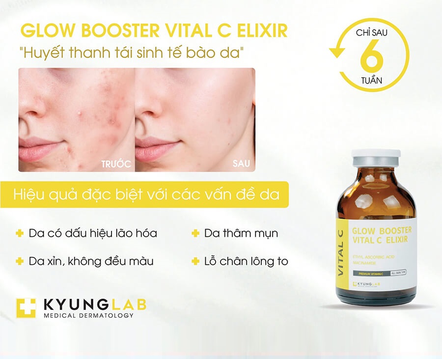 Huyết Thanh Tái Sinh Tế Bào Da Kyung Lab Glow Booster Vital C Elixir - giúp kháng viêm, bảo vệ da, thu nhỏ lỗ chân lông, ngăn ngừa mụn, sạm nám da