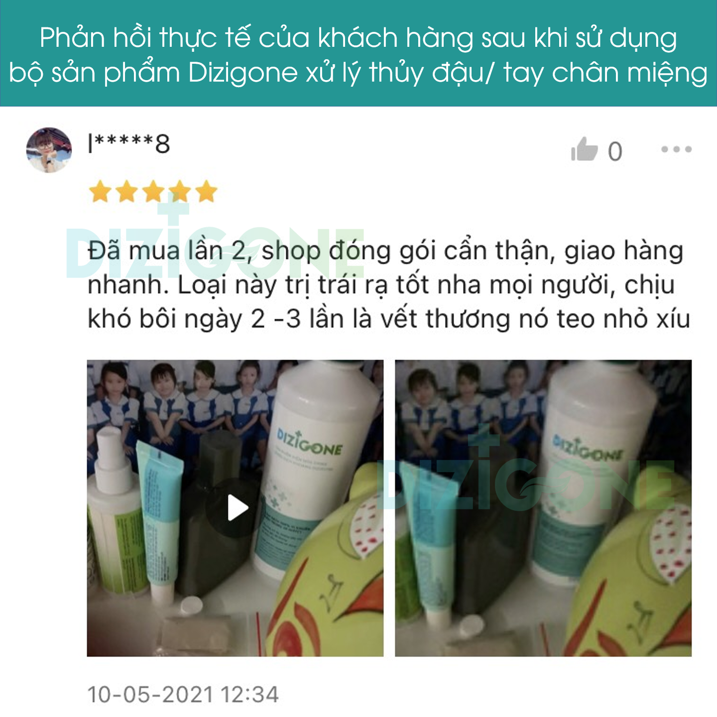 Dung dịch kháng khuẩn DIZIGONE chăm sóc tổn thương lành nhanh, không đau xót, tái tạo da, ngăn ngừa sẹo 300ml