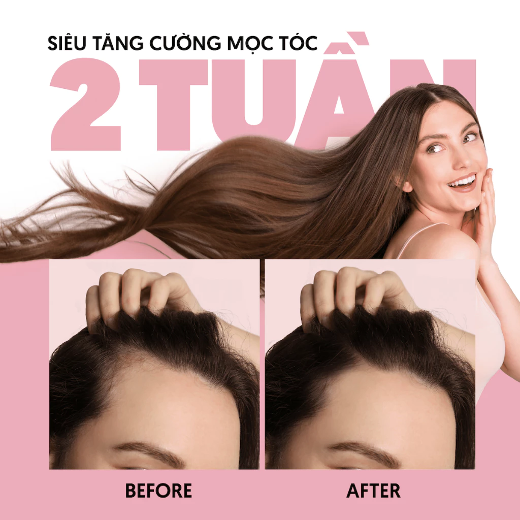 Dầu gội MILAGANICS - Keratin &amp; Biotin, mọc tóc nhanh, ngừa rụng, hiệu quả sau 2 tuần - 240ml