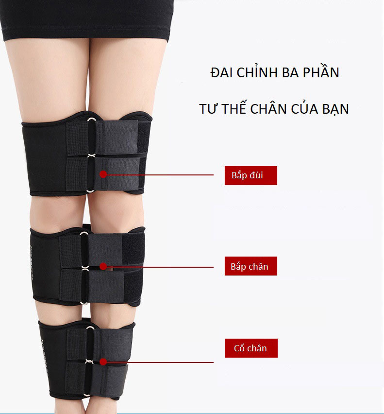 Đai Định Hình Tùy Chỉnh Chân Bị Cong Vòng Kiềng II Cao Cấp