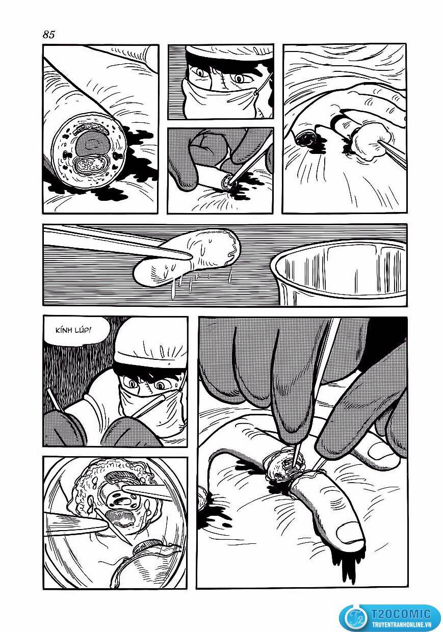 bác sĩ quái dị chapter 174 17