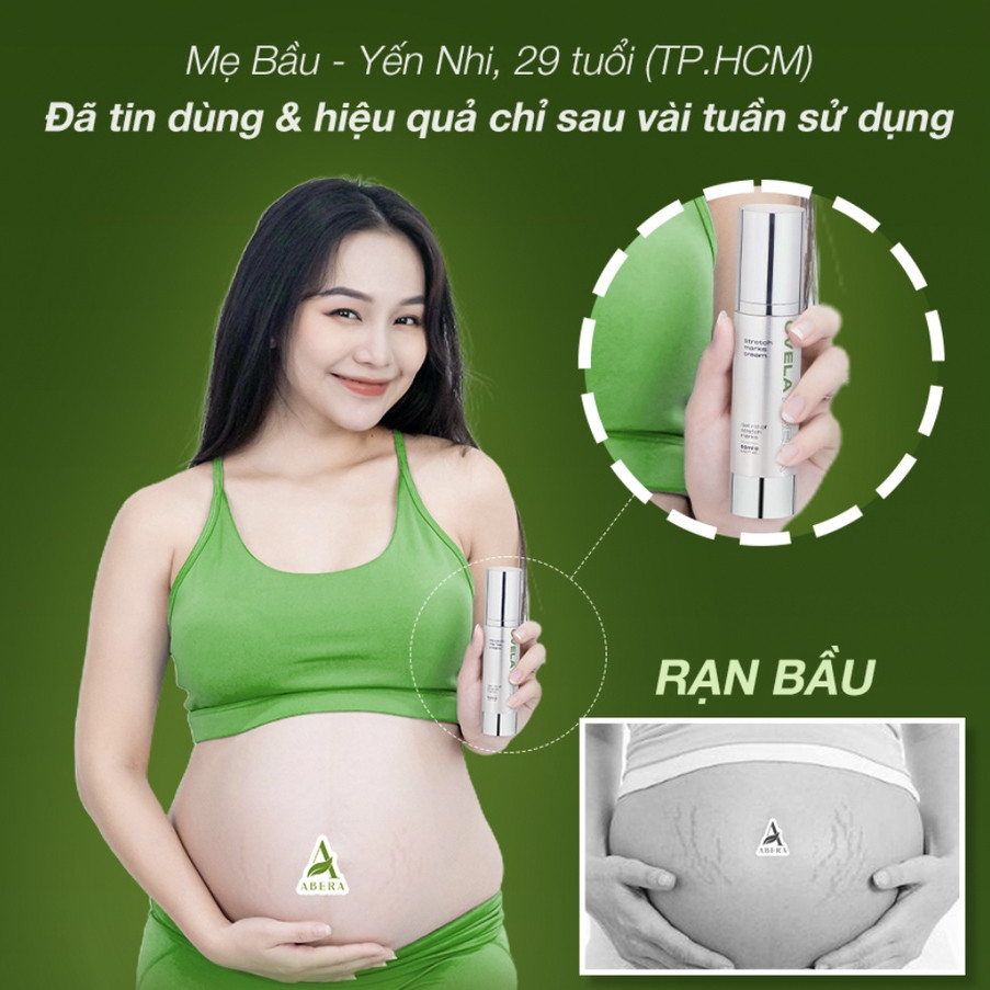 Kem Rạn Da OVELA ABERA 50ML, Dưỡng Ẩm, Giảm Rạn Cũ, Ngừa Rạn Mới, Mờ Thâm Bụng, Xóa Tan Mọi Âu Lo Về Rạn Da Cho Mẹ Bầu