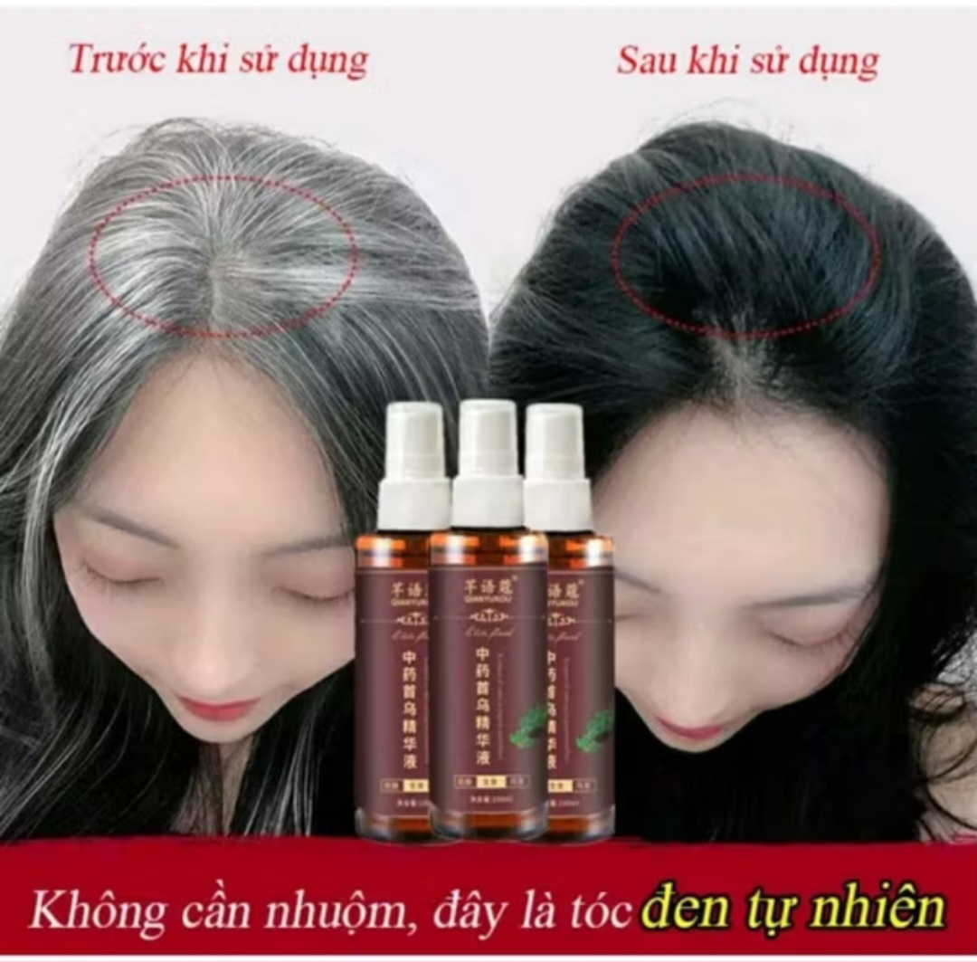 CHAI TINH DẦU THẢO MỘC XỊT ĐEN TÓC BÓNG MƯỢT ĐẸP TÓC TRẮNG THÀNH TÓC ĐEN DƯỠNG TÓC CAO CẤP