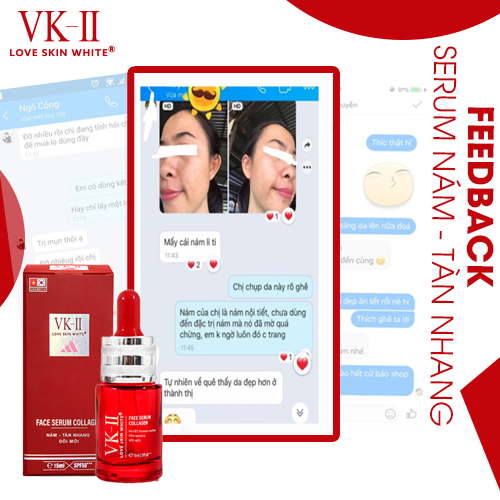 Serum Ngừa Nám Tàn Nhang Đồi Mồi VK II ( 15ml/35ml )