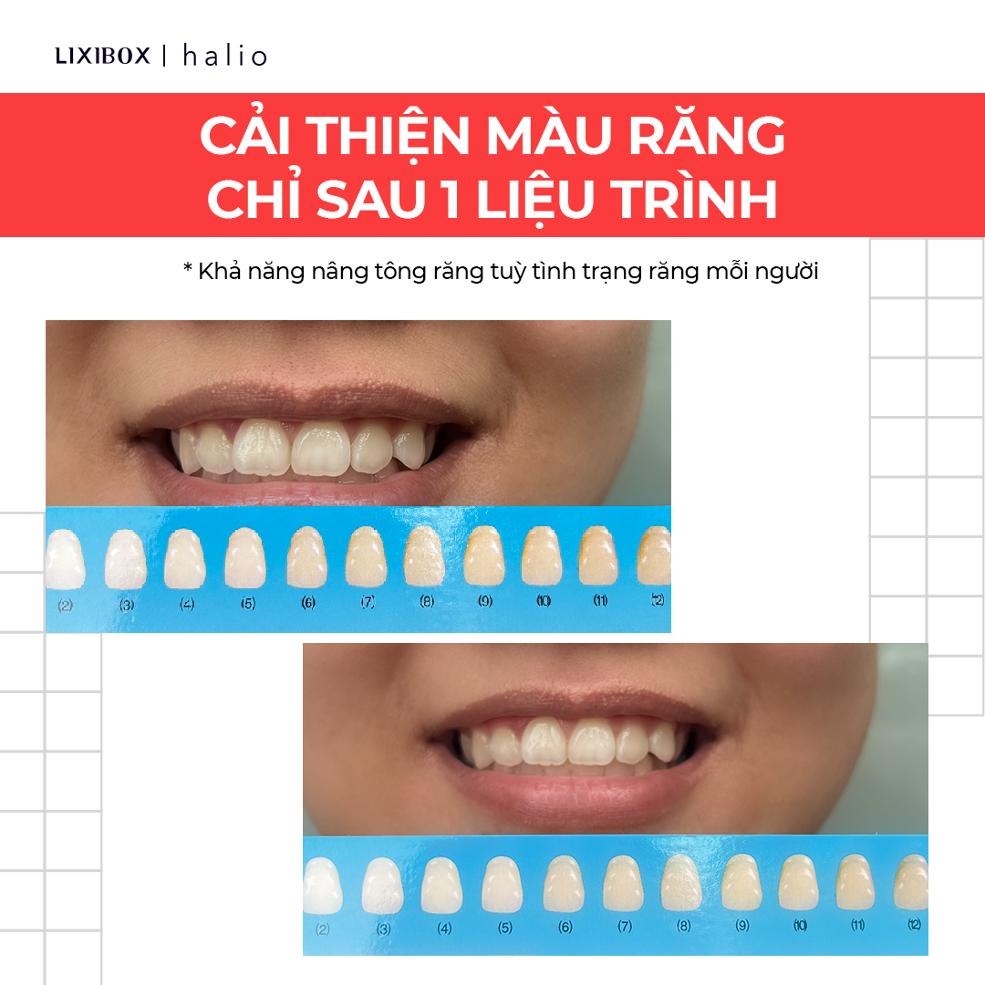 Set 7 Miếng Dán Trắng Răng Halio Teeth Whitening Strip Giảm Ê Buốt - Liệu Trình 7 Ngày