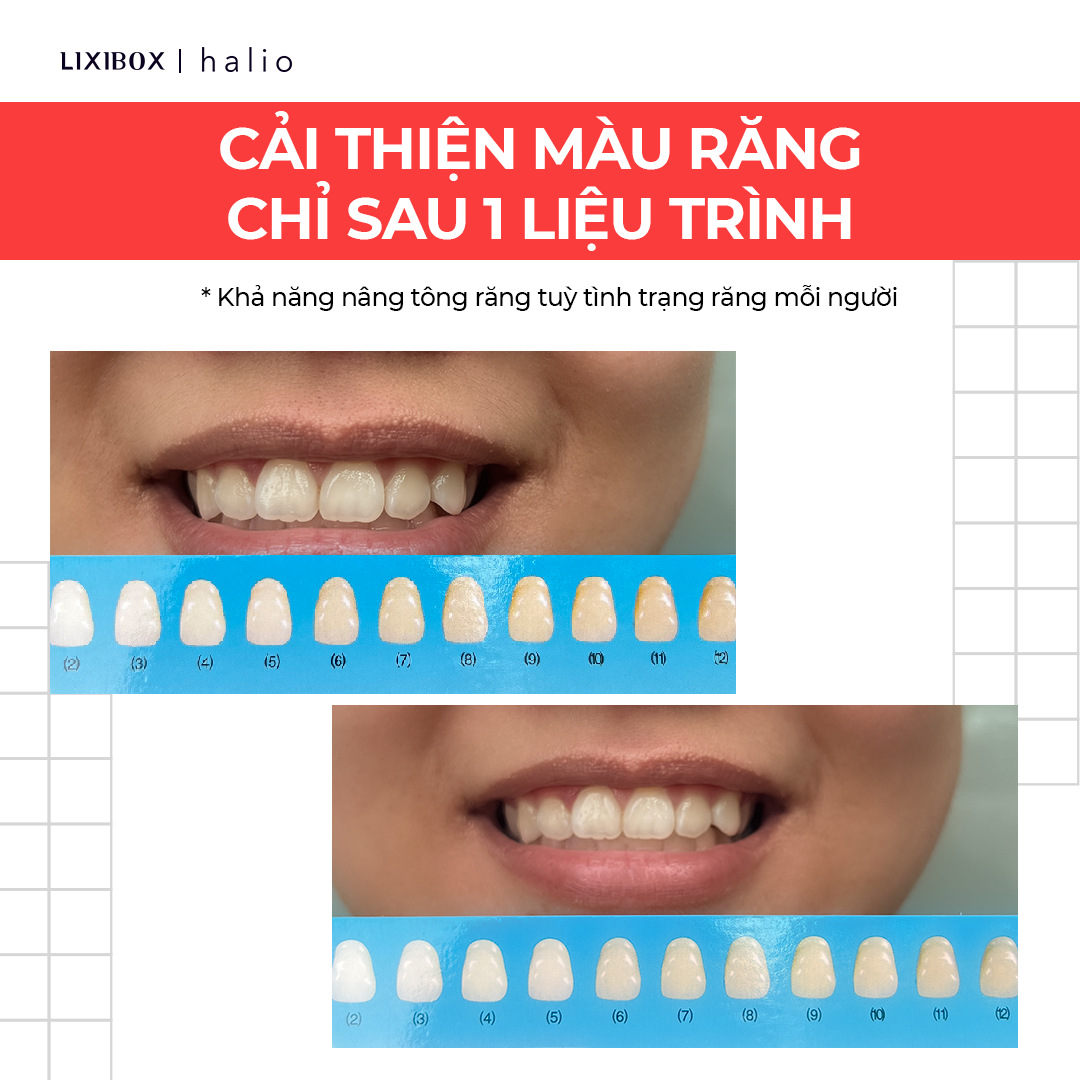 Set 14 Miếng Dán Trắng Răng Halio Teeth Whitening Strip Giảm Ê Buốt - Liệu Trình 7 Ngày