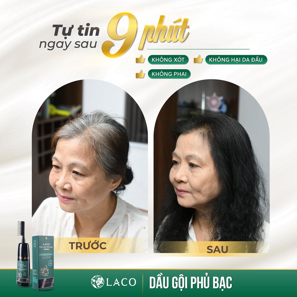 Dầu Gội Phủ Bạc chính hãng Laco Black Hair 200ml giúp tóc đen tự tin sau 9 phút