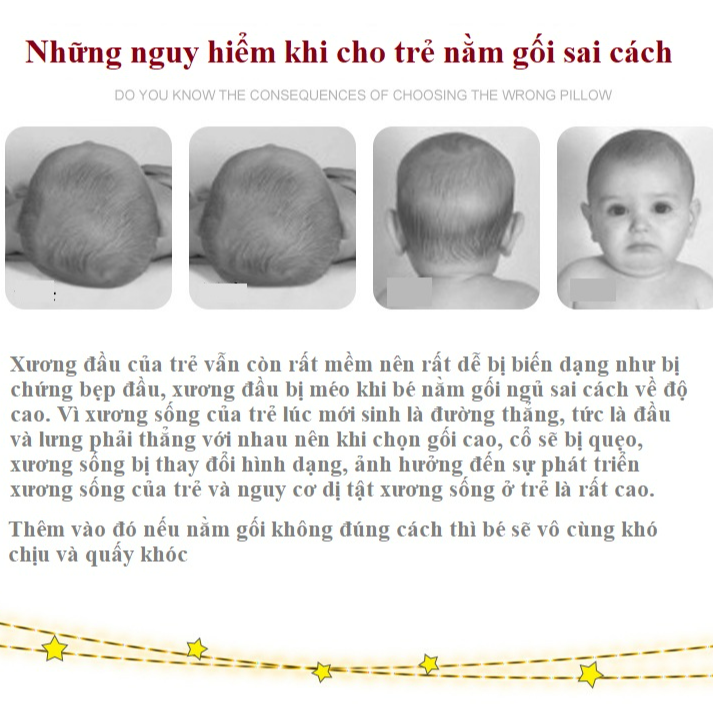 Gối Cho Bé Sơ Sinh Cao Cấp Tila-Tila Mã TG01 Ruột Gối Làm Từ Thảo Mộc Tự Nhiên, Chất Liệu 100% Cotton Luôn Thoáng Mát Cho Trẻ, Chống Méo Đầu Bẹp Đầu - Hàng Chính Hãng