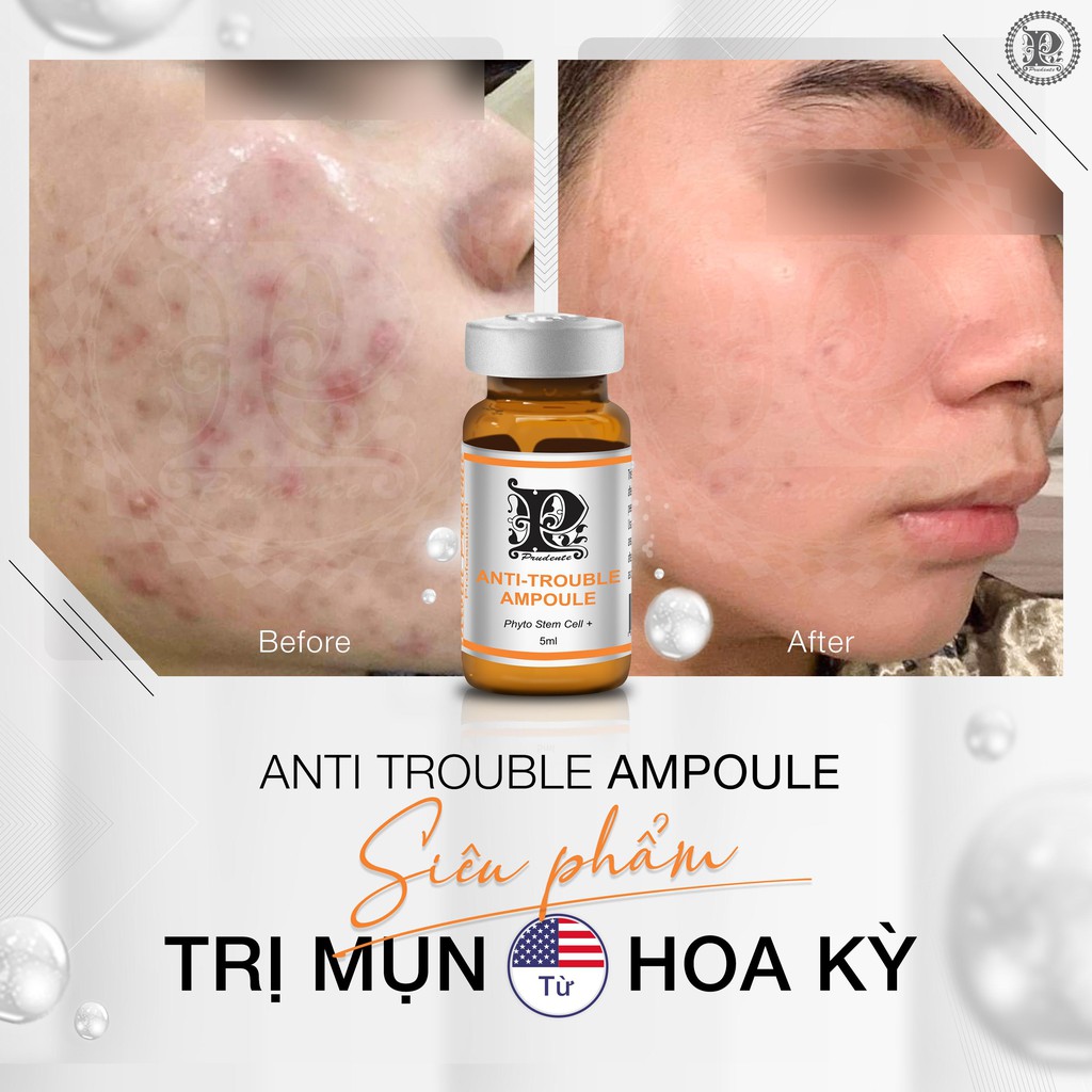 Tinh Chất Giảm Mụn Anti Trouble Ampoule Nuwhite Mibiti Prudente Professional 5ml Từ USA