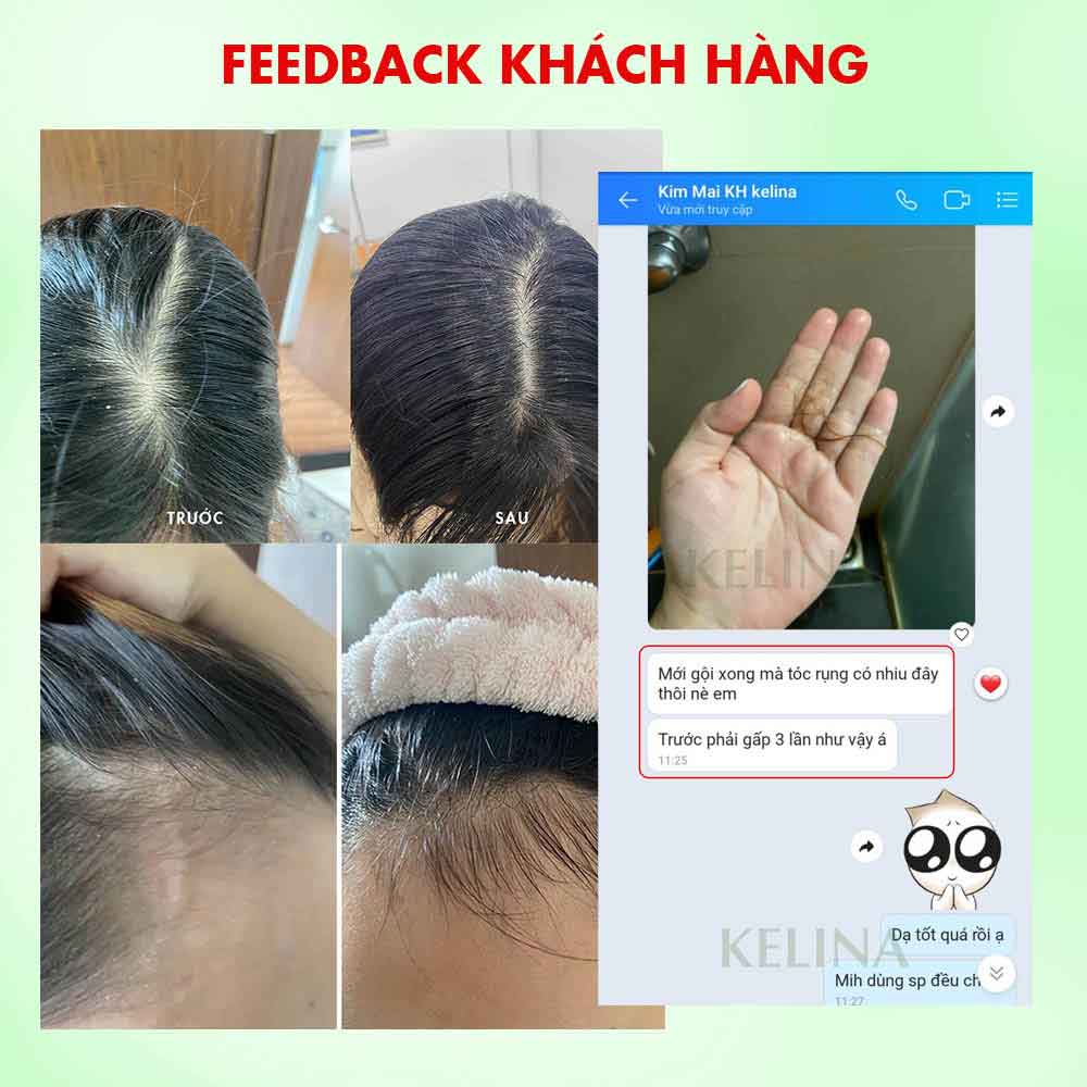 Dầu Gội Kích Mọc Tóc Kelina Size Mini 30ml