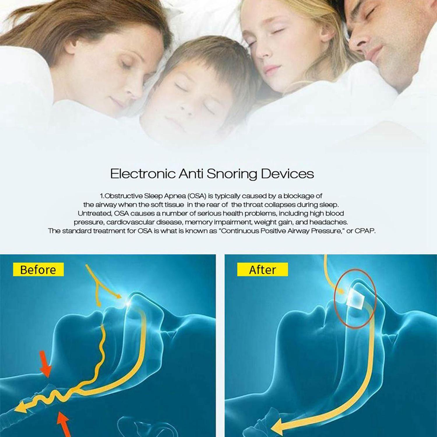 Thiết bị kẹp mũi chống ngáy, chất liệu silicone