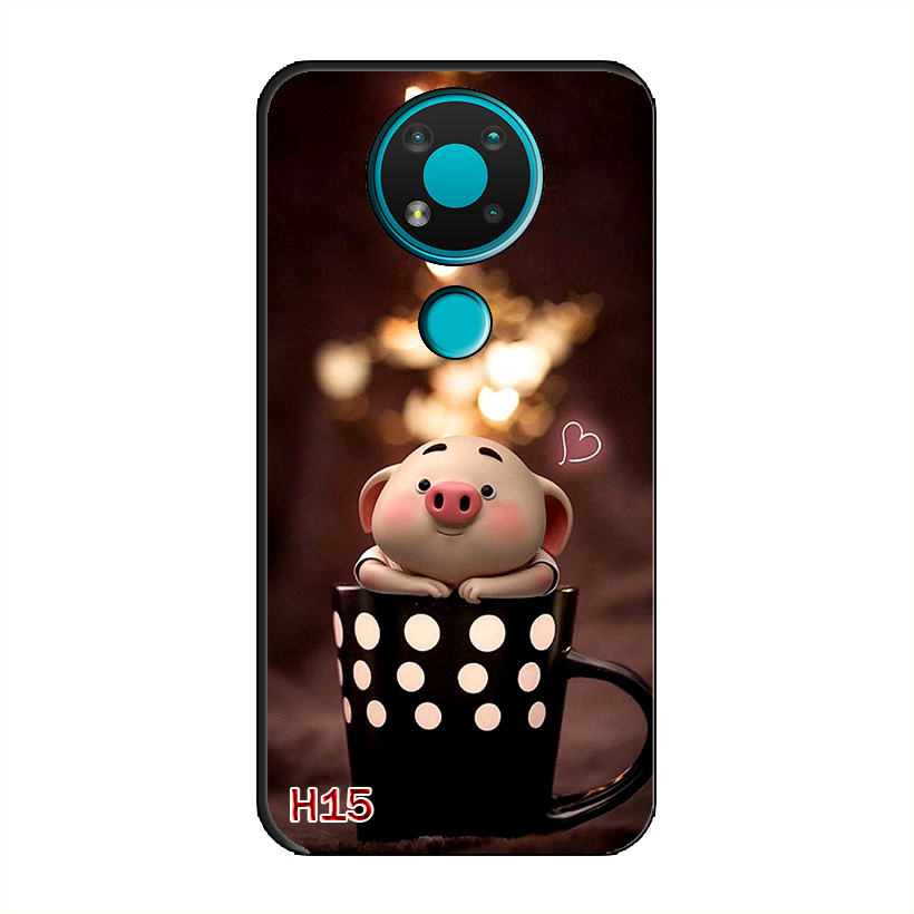 Ốp Dẻo Dành Cho NOKIA 3.4