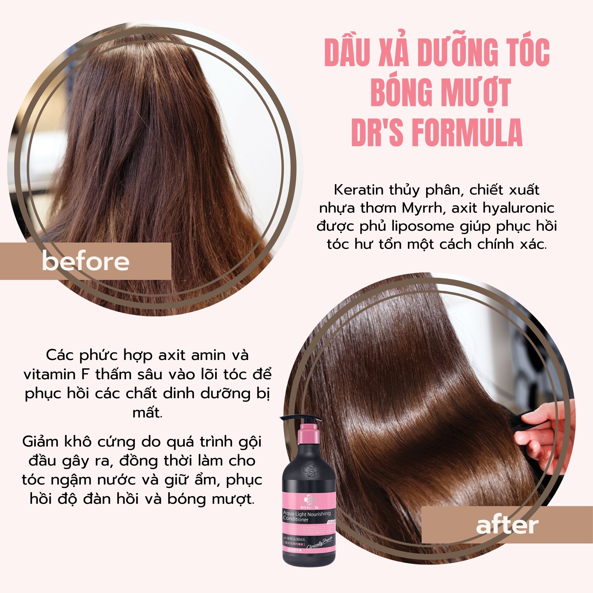 Combo Dầu gội xả Ngăn gàu giảm dầu dưỡng tóc bóng mượt