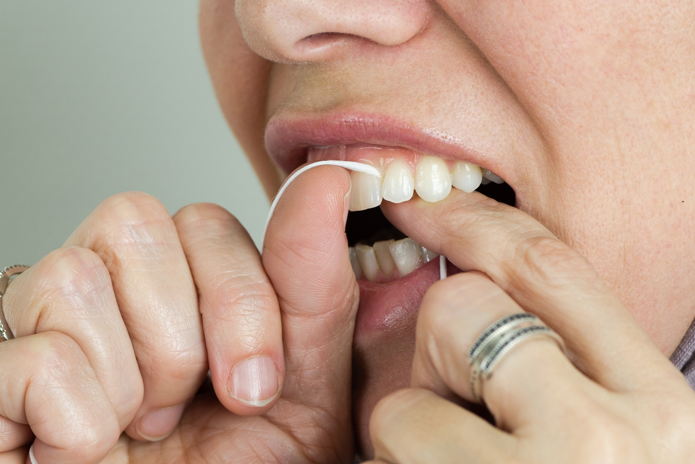 Chỉ Nha Khoa Tepe Dental Floss 5m (Hương Bạc Hà) – Loại Bỏ Mảng Bám Kẽ Răng, Sợi Mảnh Bền Chắc - Nhập Khẩu Thuỵ Điển