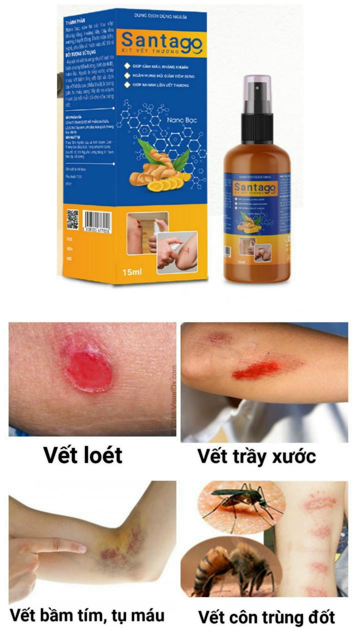 XỊT VẾT THƯƠNG SANTAGO