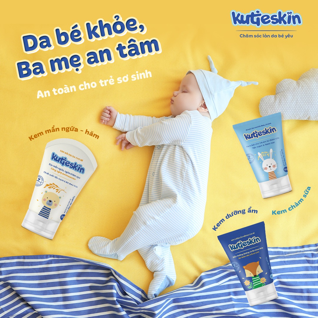 Kutieskin 30gr Kem mẩn ngứa – hăm Kutieskin