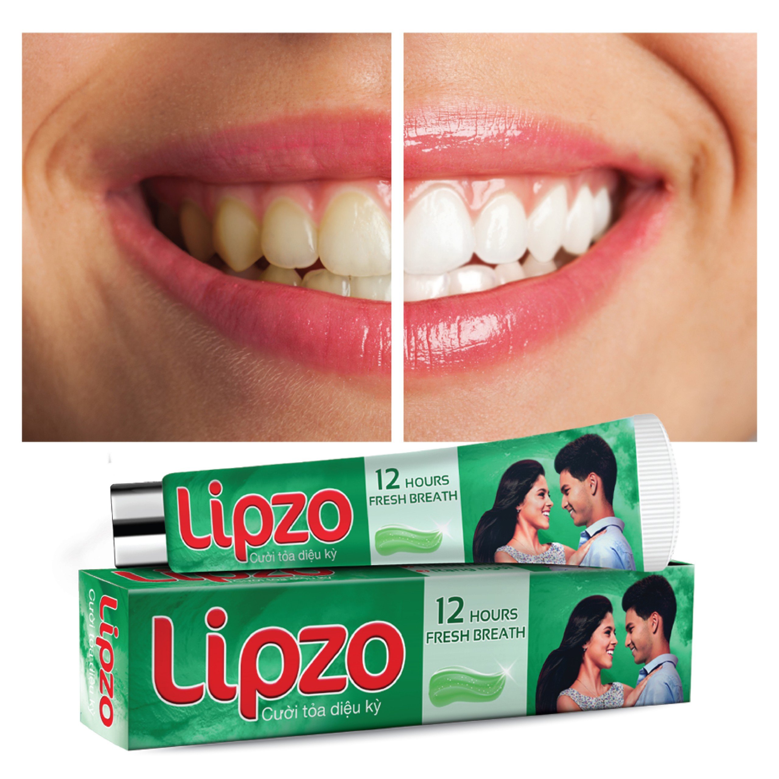 Kem Đánh Răng Lipzo 12 Giờ Rạng Ngời 185g Bảo Vệ Răng Khỏi Vi Khuẩn Gây Sâu Răng Và  Hôi Miệng