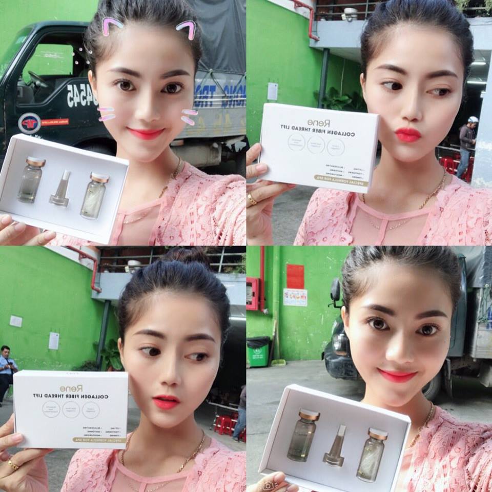 Trẻ Hóa Nâng Cơ Da Tức Thì - Collagen Fiber Thread Lift