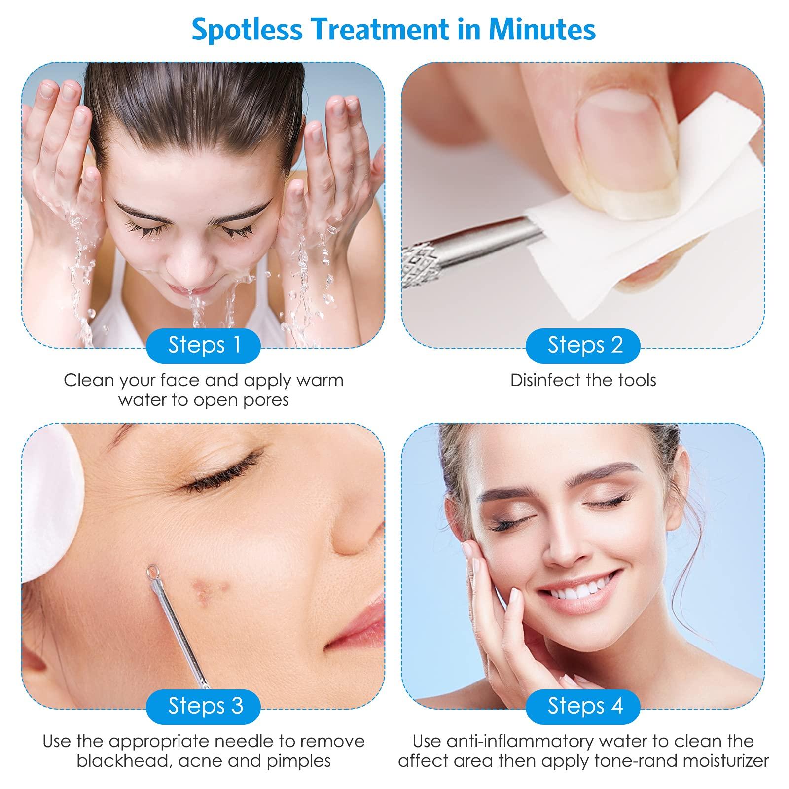 Chất chiết xuất điểm đen 10 mảnh, Kim kìm chuyên nghiệp Chim kìm đen, Thép không gỉ đầu màu đen với hộp lưu trữ kim loại, để  các diễn viên hài, nút và mụn mủ