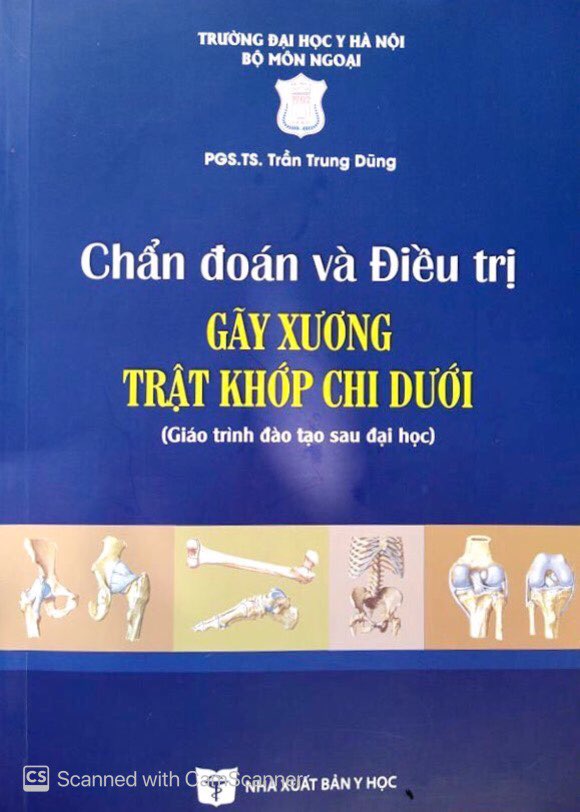 Chẩn đoán và điều trị Gãy xương trật khớp Chi trên - Chi dưới