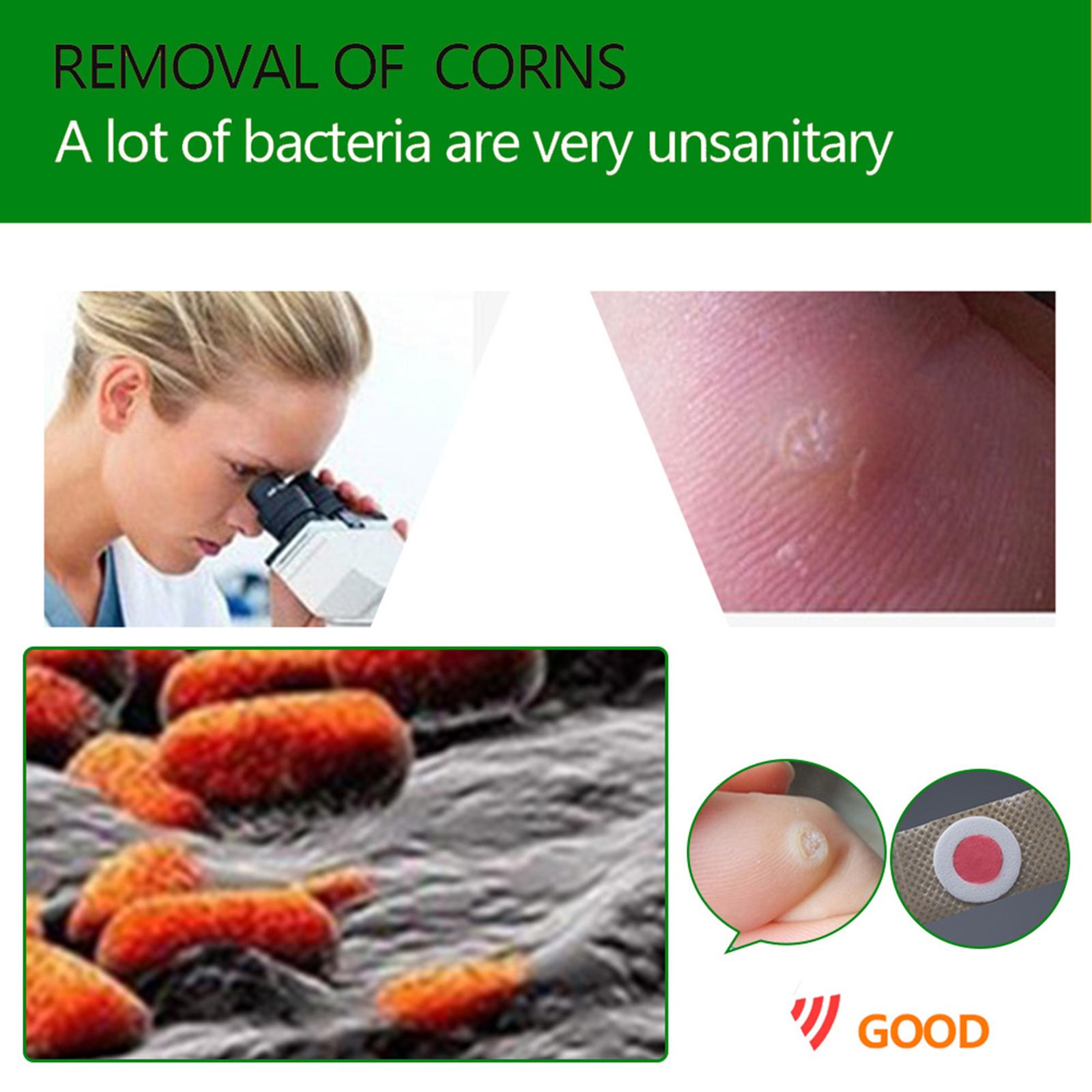 Cornside patch Ointment 42 tablets/box K04401