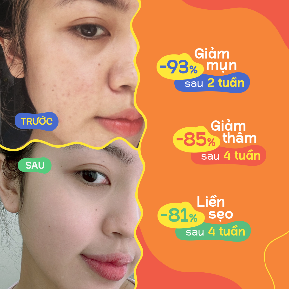 Kem chấm mụn rau má Oribe Cica Formula giảm mụn mờ thâm ngăn ngừa sẹo mụn 20g