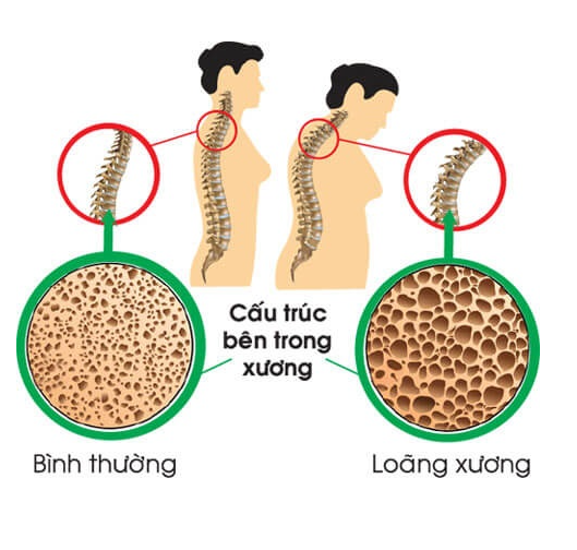 Sữa Bột Nucalci Gold 51 Tuổi Trở Lên