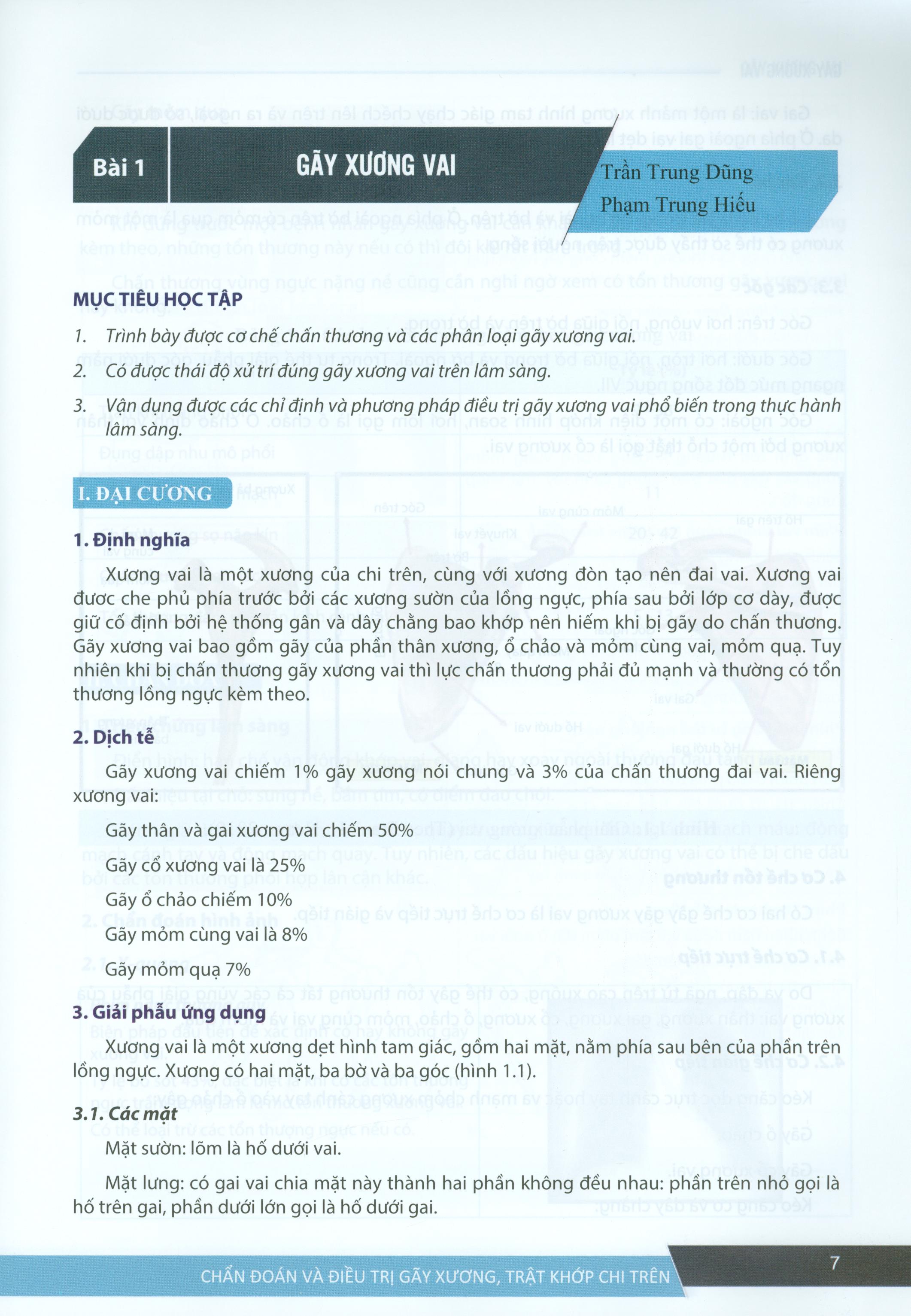 Chẩn Đoán Và Điều Trị Gãy Xương Trật Khớp Chi Trên