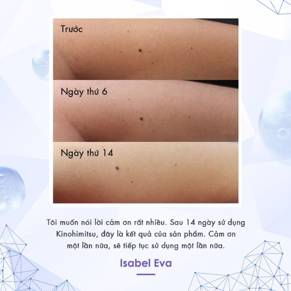 Bột uống Glutathione Giúp Trắng Da, Khoẻ Gan Prowhite Hộp 10 gói