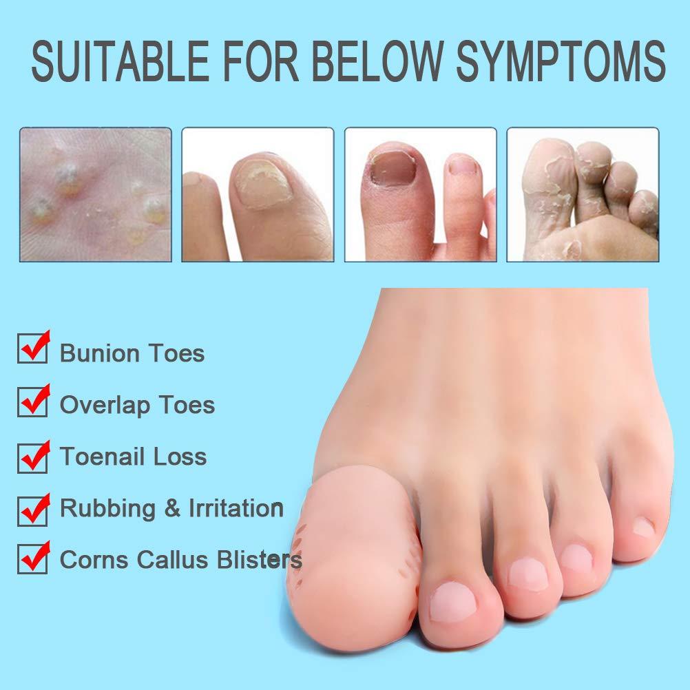 Ngón chân to, 10 miếng bảo vệ ngón chân silicon, bảo vệ ngón chân, tay áo ngón chân, cho bong bóng, mắt gà, ngón chân búa, giảm đau do ma sát và nhiều hơn nữa.