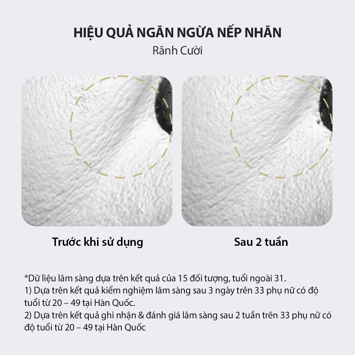 [New] Sữa dưỡng chống nắng Laneige Perfect Renew 5D Sun Protector Essence SPF50 PA+++ 50ml