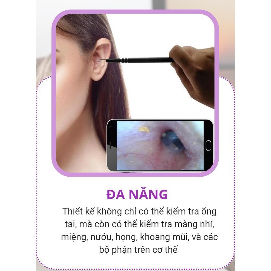 Dụng Cụ Lấy Ráy Tai Tích Hợp Camera Mini