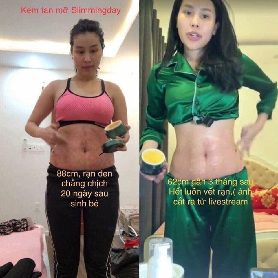 Kem Tan Mỡ Bụng Slimming Day Collagen Olive Thế Hệ Mới - Tan Mỡ Mờ Rạn Hiệu Quả Slimming Care