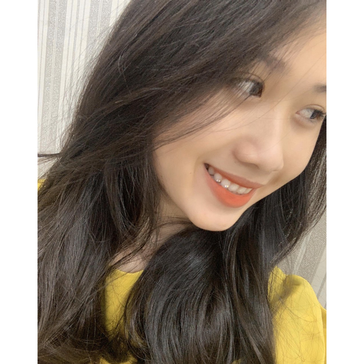 Nha Khoa Nhật Nguyệt SG - Tẩy Trắng Răng
