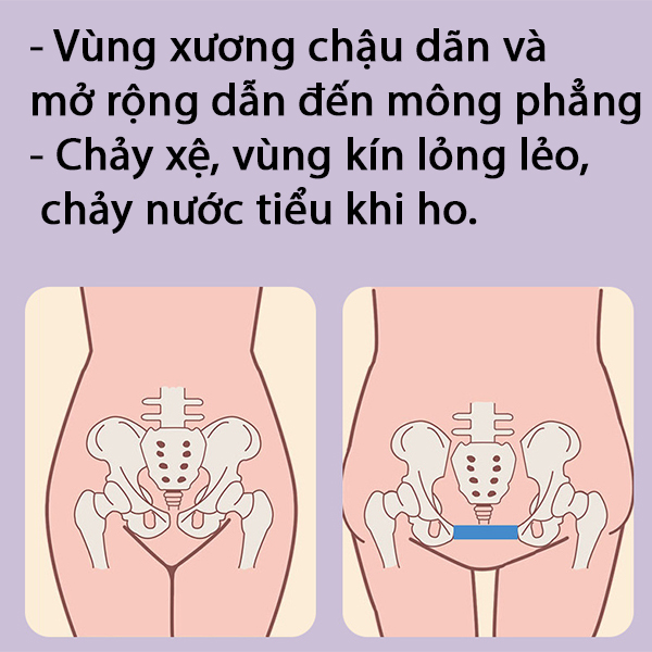 Thiết bị tập tập hông và nâng mông dành cho phụ nữ mới sinh con