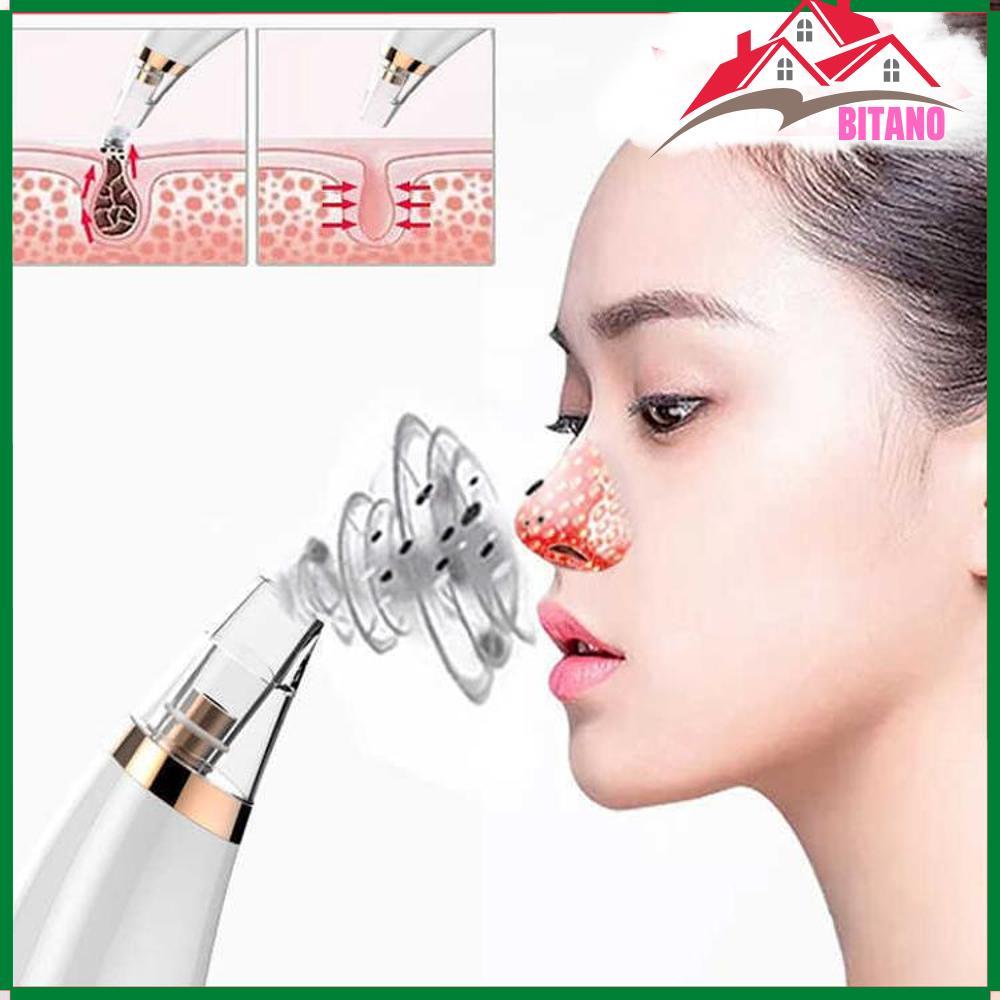 Máy Hút Mụn Cầm Tay Cao Cấp BITANO Comedo Suction Tool – Máy Nặn Mụn Siêu Êm, Mạnh Mẽ (Tặng Kèm 2 Pin 2A)