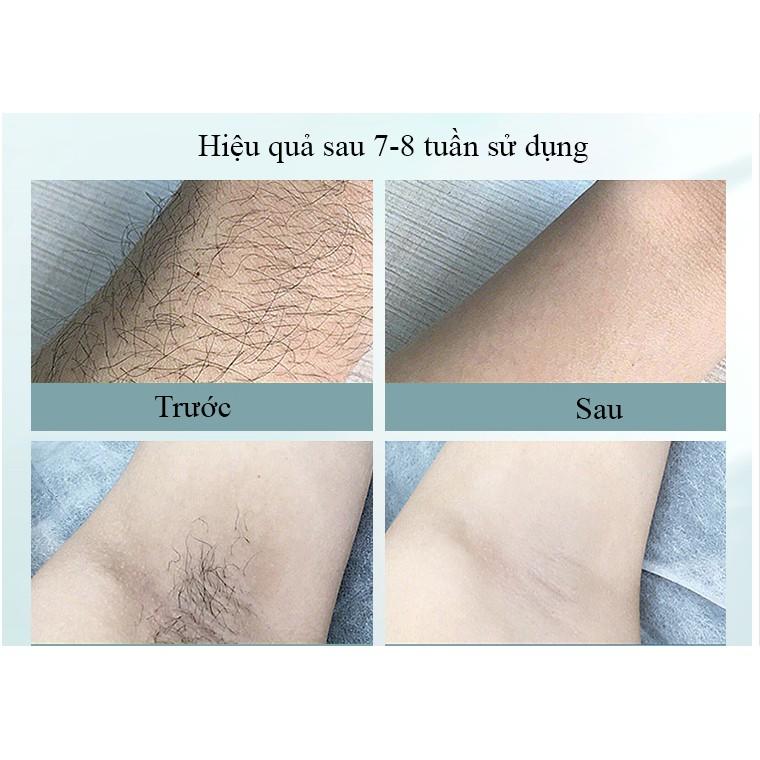 Máy triệt lông cầm tay RULAX phiên bản 2021 công nghệ trẻ hóa da tự động