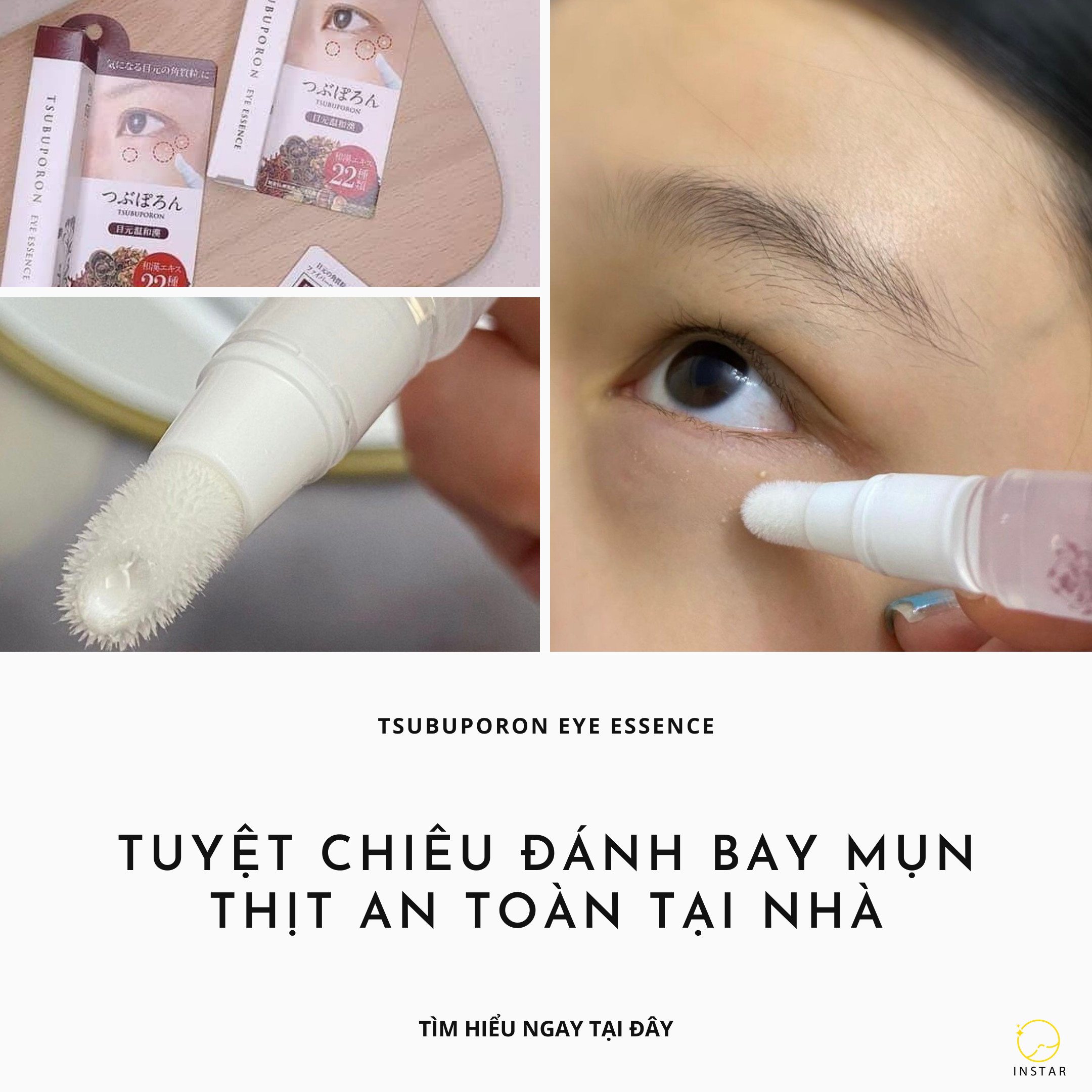 BÚT LÀM MỜ MỤN THỊT VÙNG MẮT TSUBUPORON EYE ESSENCE - XÓA MỤN THỊT NHẬT BẢN