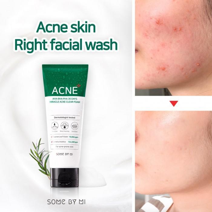Combo Hỗ Trợ Giảm Mụn Some By Mi AHA-BHA-PHA 30 Days Miracle