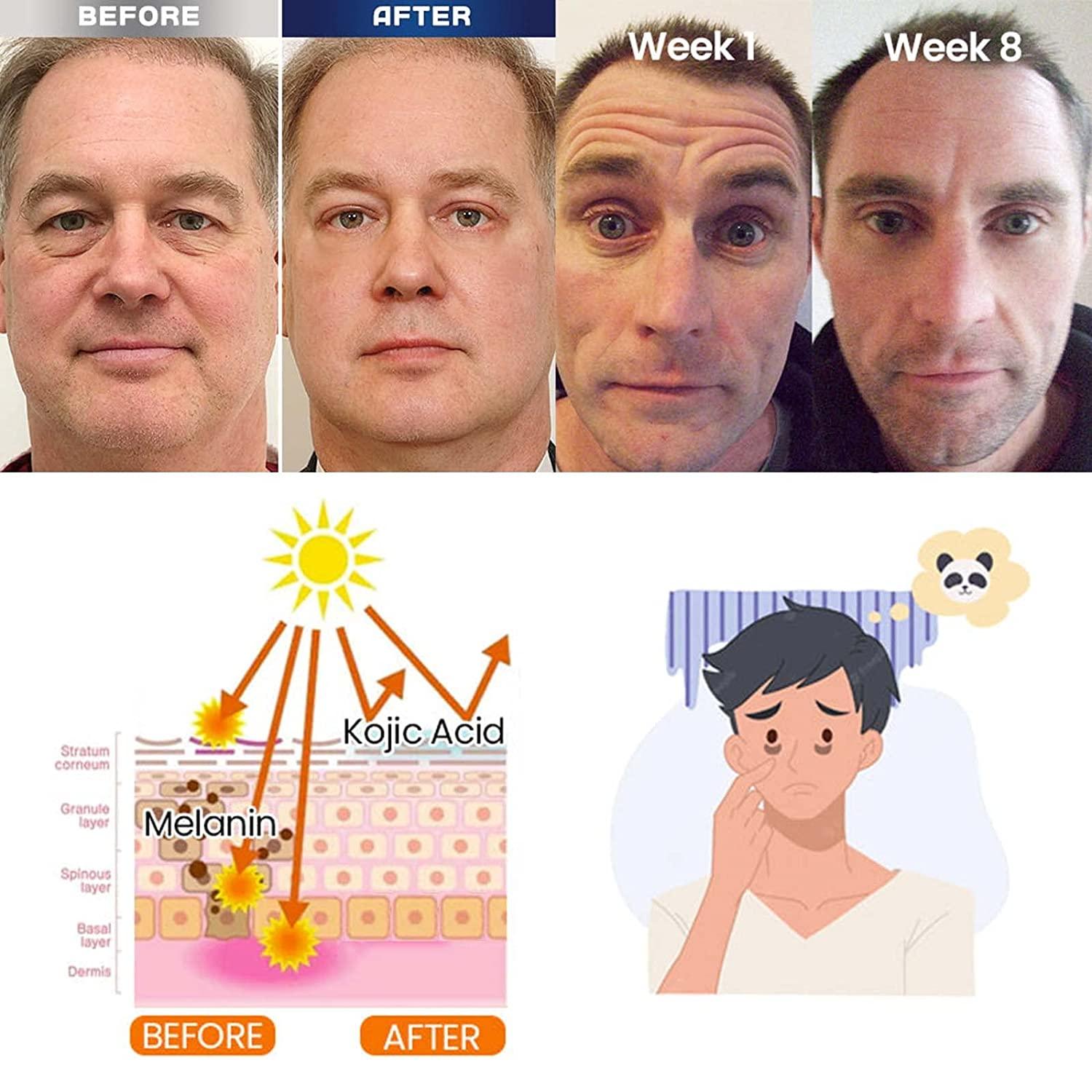 Kem dưỡng ẩm cho nam giới, giảm sưng, quầng thâm, túi nước mắt, nếp nhăn và nếp nhăn quanh mắt