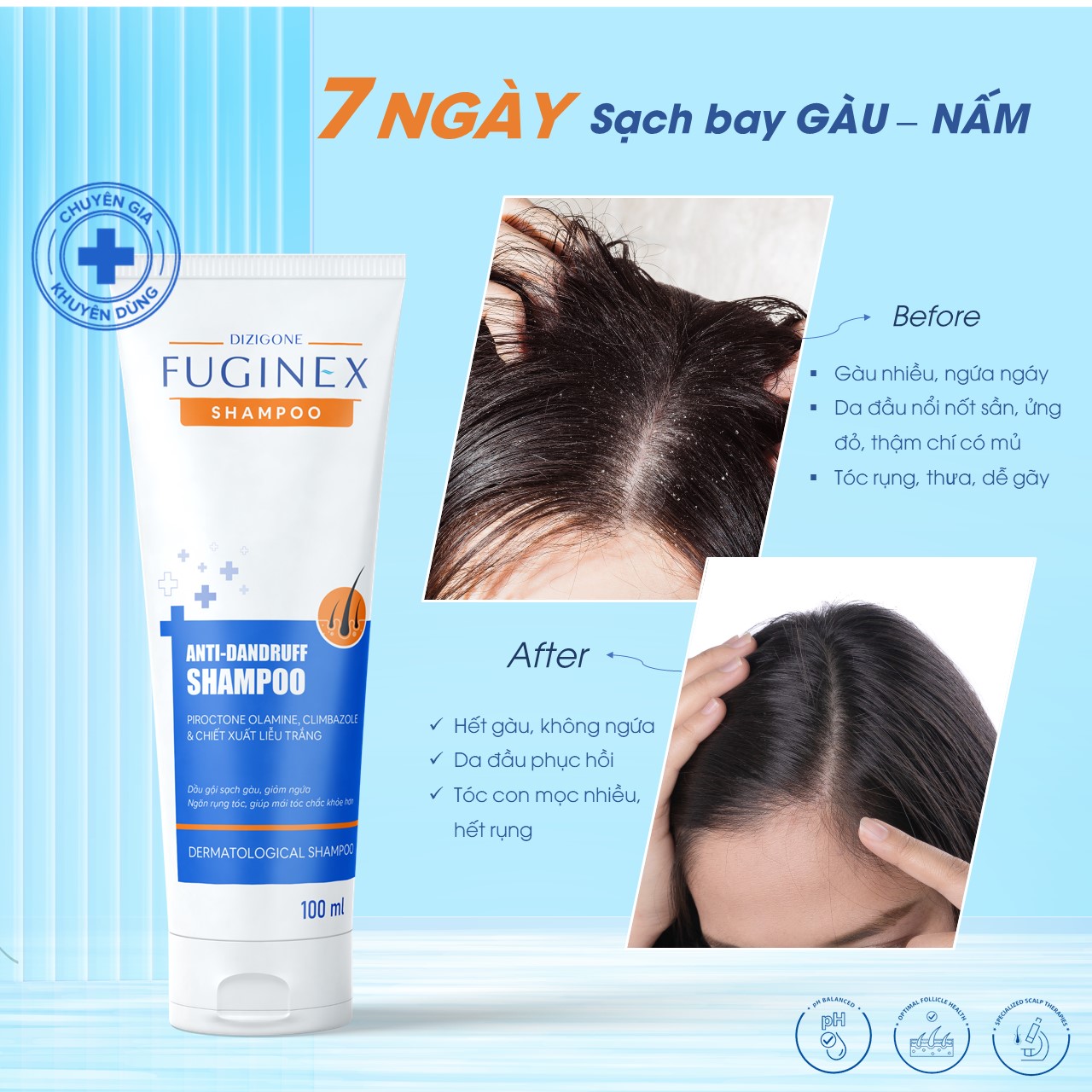 Dầu gội Dizigone Fuginex Anti-Dandruff Shampoo 100ml - Chuyên biệt cho gàu, nấm ngứa da đầu