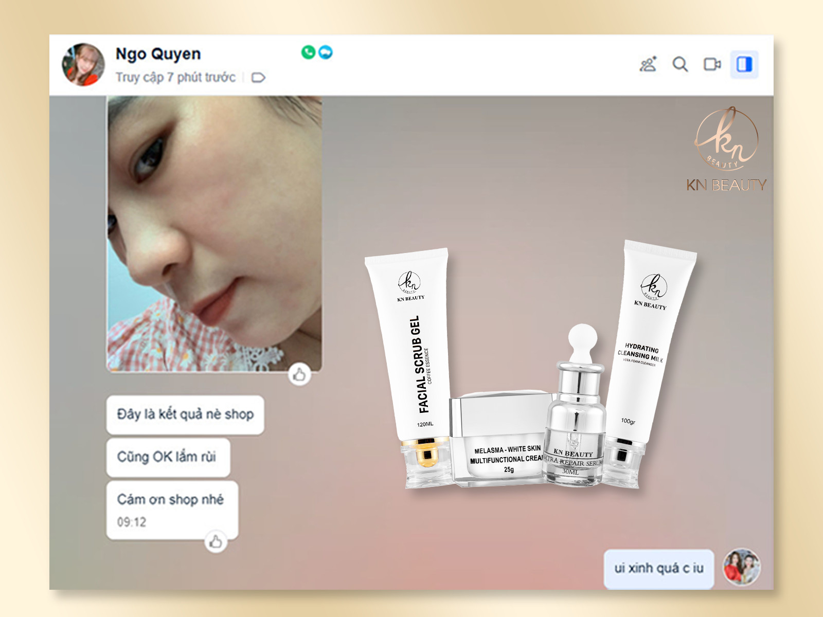 Bộ 3 sản phẩm Xóa Mờ Thâm Nám, Tàn Nhang, Đồi Mồi, Làm Trắng Da, Chống Nắng KN Beauty chuyên sâu : Kem dưỡng 25g + Serum 30ml + Tẩy tế bào chết 120ml