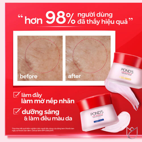 Kem Dưỡng Ẩm POND'S ngăn ngừa lão hóa Ban Đêm Dưỡng da và đều màu da