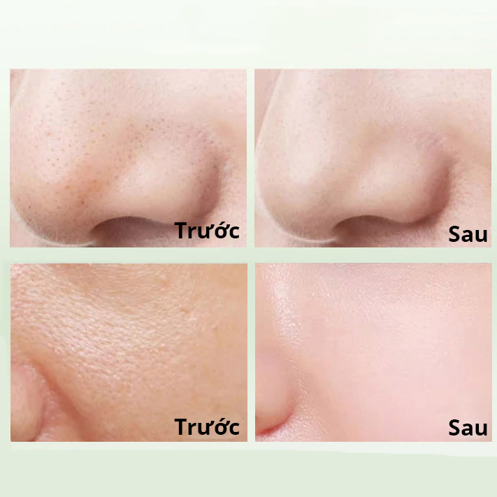 Mặt nạ bùn trà xanh giảm mụn làm sạch da TreeChada Cleansing Mask Thái Lan 100g