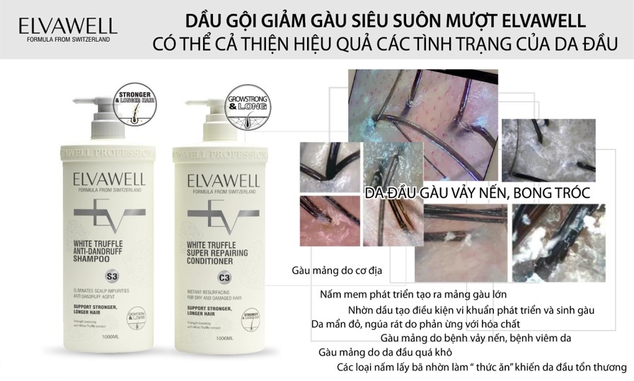 Dầu gội xả giảm gàu siêu suôn mượt Elvawell - 1000ml (Màu trắng)