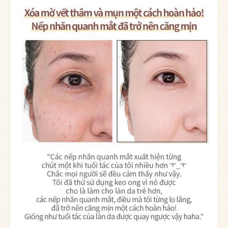 Serum Cải Thiện Nếp Nhăn Làm Trắng Da WellDerma Propolis 1000 Energy Ampoule 50ml