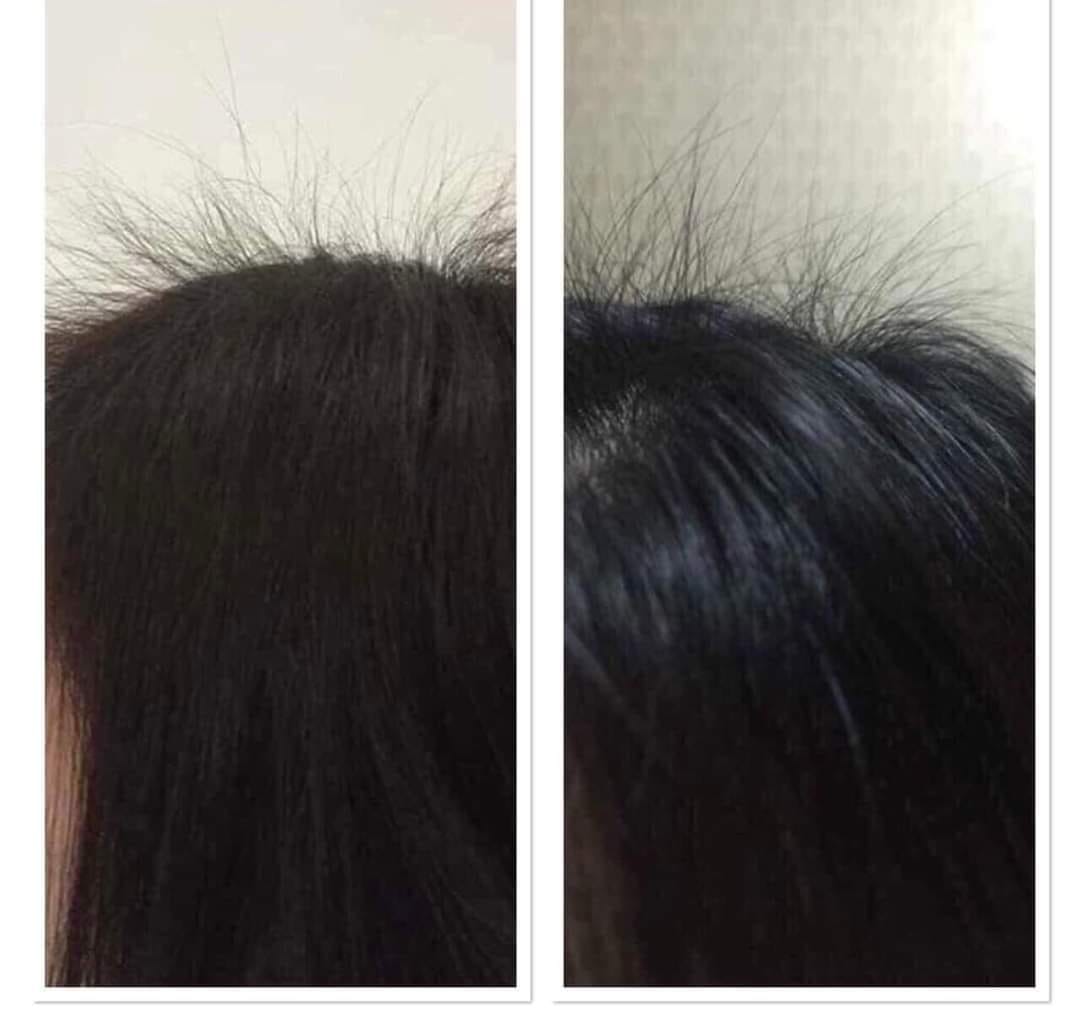 Serum Amla Detox - Dưỡng tóc, ngăn ngừa và làm giảm xơ rối tóc