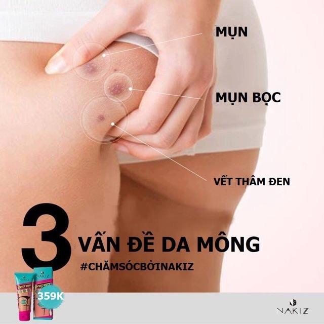 NAKIZ LIVELY BUTT Kem thoa thâm, mụn Mông, Bẹn, Nách, Lưng, Nh.ũ hoa, Cùi chỏ, Đầu gối .... Thái Lan